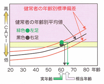 BMI